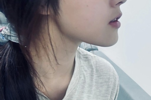贵圈女明星的疑云
